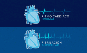 ritmo cardíaco normal