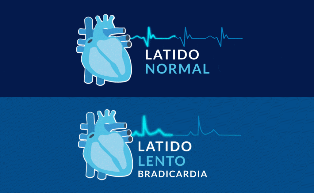 ritmo cardiaco normal