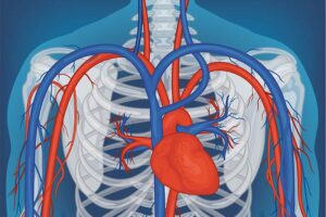 Aneurismas y disecciones Aorticas: Todo lo que debes saber. 